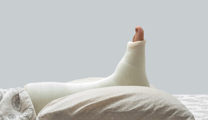 broken ankle and a leg cast. Leg splint