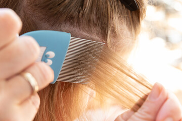 head lice head treatment,stock photography - obrazy, fototapety, plakaty
