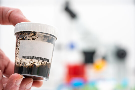 soil sample for chemical and bacteriological analysis in scientific laboratory