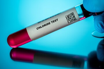 Chloride Test Blood Tests for Older Adults. Recommended Blood Test for the Elderly