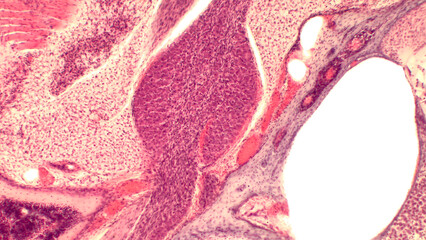 Inner ear cochlea histology. Organ of Corti (spiral organ). Haematoxylin and eosin stain. 