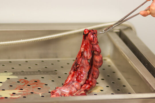 Doctor's hand holds the dog's pyometra uterus with surgical forceps. Uterus inflammation after operation to remove.