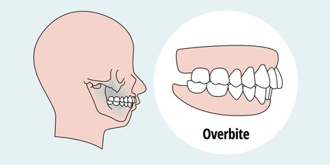 Side view of man after orthodontic treatment, right teeth aligned