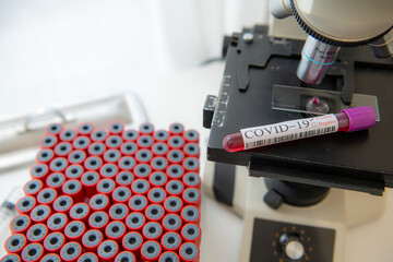 Coronavirus 2019-nCoV Blood Sample. New Epidemic Corona Virus. Corona virus outbreaking. Corona Virus in Lab. Scientist hold tube with Blood Test with the Virus Name Coronavirus. vaccine