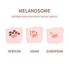 Melanosome distribution pattern and skin tone pigmentation mechanism. Melanin pigment content in different ethnic skin types. Vector illustration.