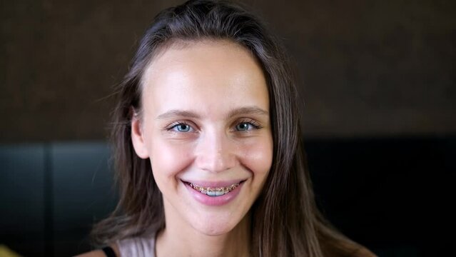 Beautiful smiling girl with brackets for teeth. Smiling woman. Female smile with dental braces close up. Braces Mouth