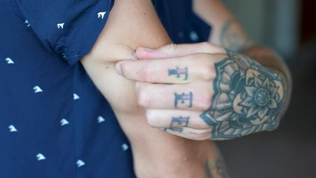 Young man takes off old diabetic measuring sensor to replace it with a fresh one