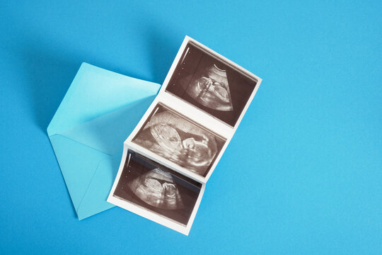 Ultrasound picture pregnant baby photo and envelope on blue background