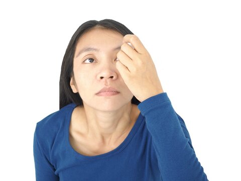 Young woman apply eye drops. girl glaucoma treatment. Closeup photo, blurred.