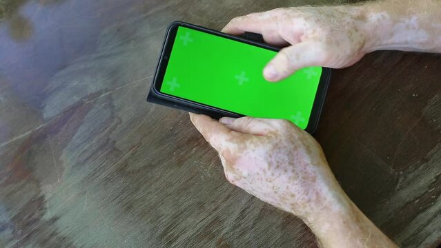 A man suffering from vitiligo uses a phone with a green layout. Surfing the internet viewing content videos blogs training. Video games. Hands close-up.