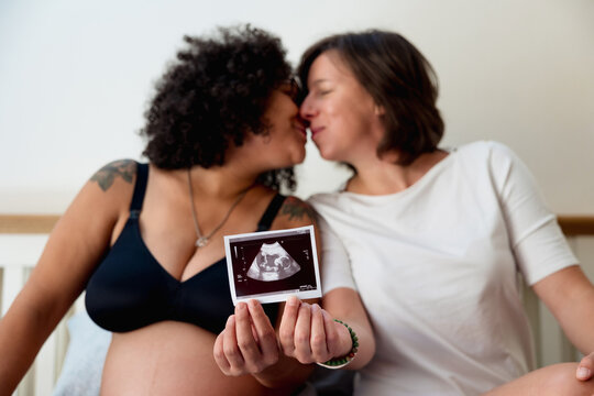 Expectant couple kissing while holding and showing an ultrasound scan picture of their baby. Lgbt couple and pregnancy concept.