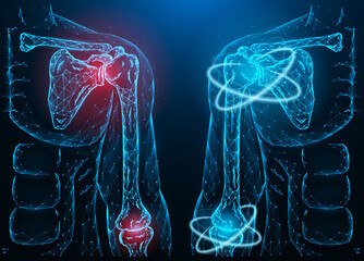 Polygonal vector illustration of a diseased inflamed human shoulder and elbow joint and recovery of shoulder and elbow function. Medical banner, template or background.