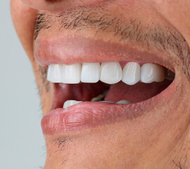 white perfect teeth man perfect smile