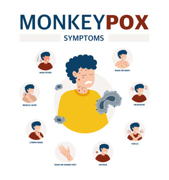 Monkey pox virus Poster to inform about the pandemic and the spread of the disease Images of a person and symptoms of the disease Vector illustration