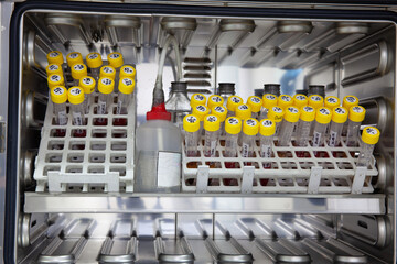 Test tubes with blood samples in the incubator during the process of preparation for karyotype and fluorescence in situ hybridization - FISH in the laboratory - obrazy, fototapety, plakaty