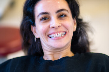 dental braces of a woman at dentist office 
