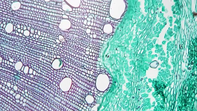 Scientific sample of stem of xylophyta dicotyledon in transversal section shown under microscope with 200 times magnification against bright field. Slide with a piece of plant for study in laboratory.
