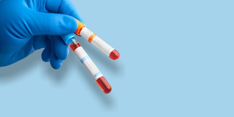 Doctor holding a test sample tube.The virus concept.