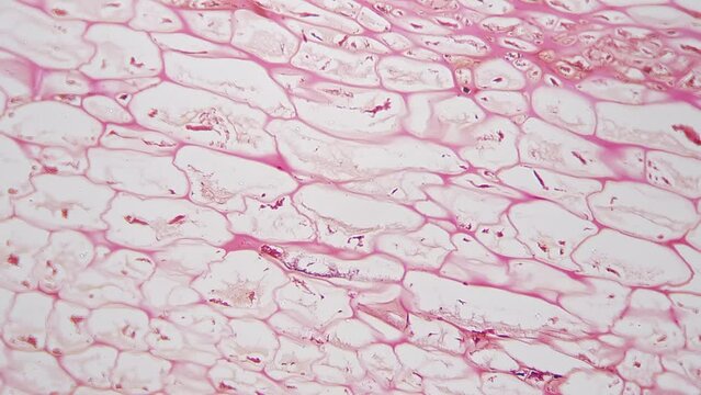 Polliondium of Funaria in longitudinal section under microscope 200x against bright field. Macro footage of cut moss filmed by special lab device for viewing its structure with cells and nucleus.