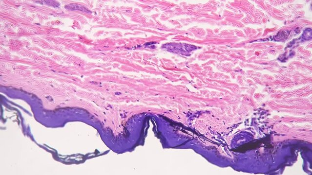 Microscopic 200x view of human skin with shown sweat glands against bright field. Macro footage of epidermis layers multiply magnified for analyzing people perspiration process. Lab investigation
