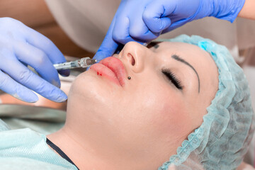 Lip augmentation. Beautician injects hyaluronic acid into the lips of a girl with a syringe. The cosmetologist doctor performs the procedure in the cosmetology office. Plastic surgery.