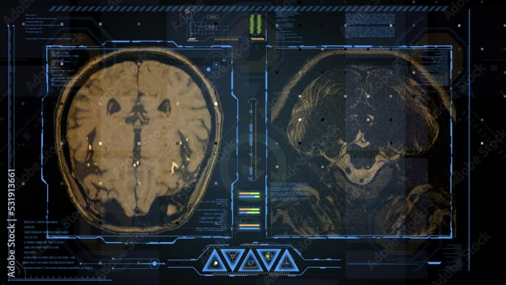Aufkleber magnetic resonance images of the brain. a high-tech screen displays the brain in 3d and monitors vit