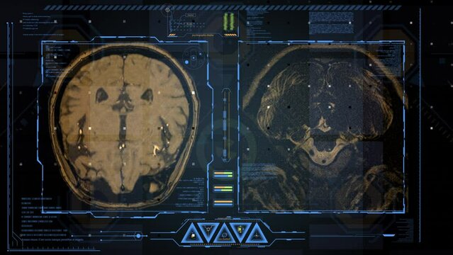 Magnetic Resonance Images of the Brain. A High-Tech Screen Displays the Brain in 3D and Monitors Vital Signs In the form of Digital Data and Diagrams 
