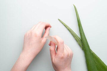 Woman applying fresh aloe vera gel piece to her hands for skin burn healing and pain relief....