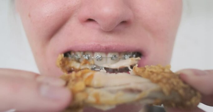 Unrecognizable female in braces bites breaded chicken wings. Close-up, front view. Jaws greedily chew meat. Satisfying hunger with fast food.