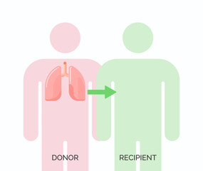 Human organ transplantation concept. Vector illustration of donor and recipient of lungs organ
