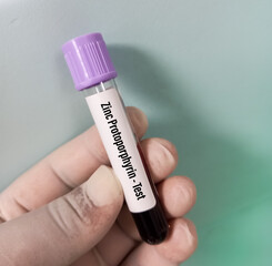 Blood sample tube for zinc protoporphyrin or ZPP test, diagnosis for for iron deficiency anemia in children and adolescents.