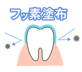 フッ素塗布治療　歯科キャラ　デンタルイラスト.