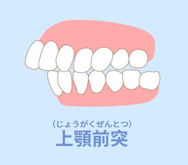 歯科矯正　歯並び　叢生、反対咬合、開咬、上顎前突、空隙歯列、すきっ歯.