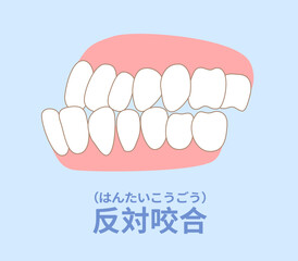 歯科矯正　歯並び　叢生、反対咬合、開咬、上顎前突、空隙歯列、すきっ歯.