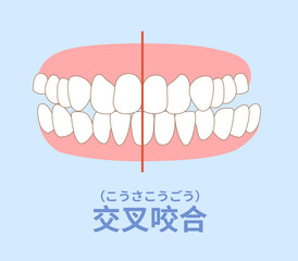 歯科矯正　歯並び　叢生、反対咬合、開咬、上顎前突、空隙歯列、すきっ歯. © sumaki