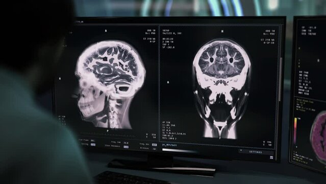 Modern Scanner analysing the injured head organs during medical therapy. Therapy doctor examines the brain injury using a scanner. Scanning the injured skull at the clinic for therapy. Deadly Injury.