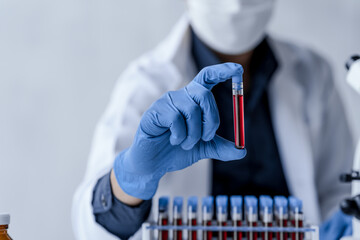 Laboratory and science experiments, chemical hand taking a blood sample tube from a rack analysis...