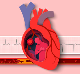 Heart attack paper cut vector cardiology disease