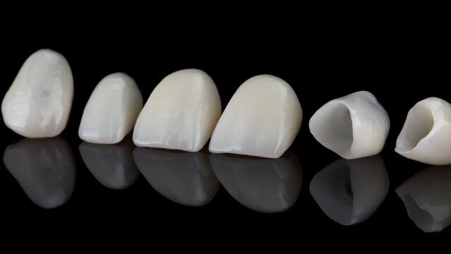 macro composition of ceramic crowns of central teeth on black glass with reflection