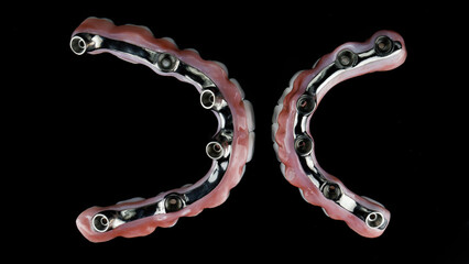 top view of two dental bars made of titanium inside the prostheses of the upper and lower jaw on a black background