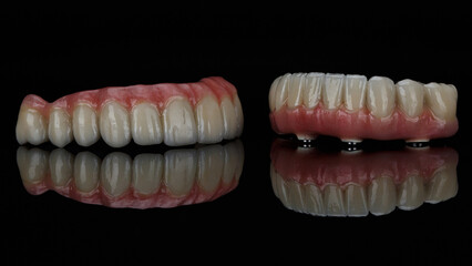 excellent dental prostheses made of ceramics with natural gums on black glass with reflection