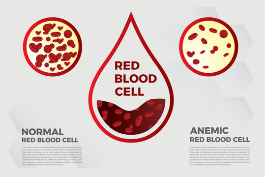 Anemia Iron red blood cell medical vector illustration medical.
