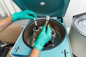 Platelet rich plasma preparation experiment. Plasma preparation syringe centrifuge.