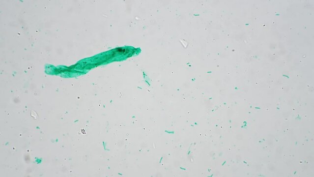 Macro footage of nostoc whole mount magnified 100x by microscope on bright field. Green cyanobacterium living in freshwater filmed under special lab equipment for the biological education.