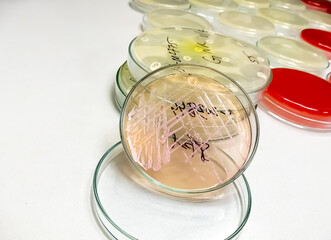 Petri dish with bacterial colony isolated in the background of a microbiology laboratory. Bacterial...