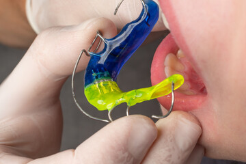 Plate for the lower teeth, orthodontic and plate for the teeth of the lower jaw. © Niko_Dali