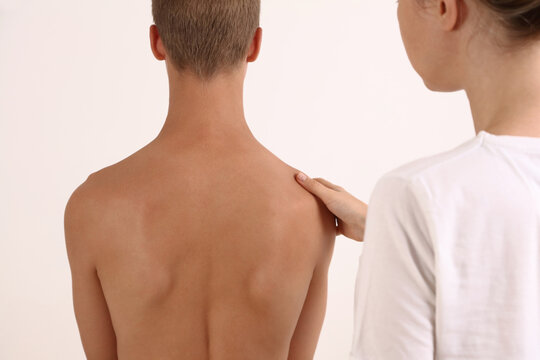 Scoliosis Spine Curve Anatomy. Adolescent Posture Correction. Chiropractic treatment, Back pain relief.