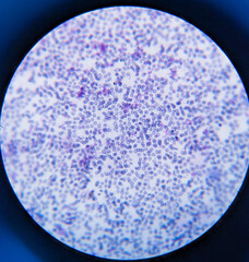 photo of human blood smear under the microscope
