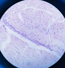 photo of white fibrous tissue under the microscope