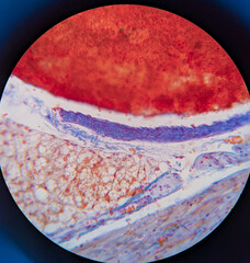 photo of heart muscle tissue under the microscope